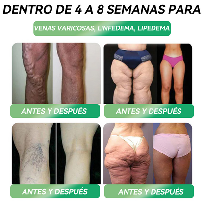 🔥 ¡Solo quedan 10 cajas! ¡30% de descuento adicional! HHVB® GLP-1 6 en 1 Líquido Oral, probado y seguro, apoya el peso, azúcar en sangre, digestión y energía con resultados duraderos.